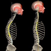 Kyphosis & Rounded Back by M&M Apk