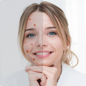 Remove Acne from Face Apk