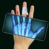 real xray camera