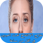 علاج الانتفاخ تحت العينين في أقل من ساعة Apk