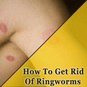 How To Get Rid Of Ringworms Apk