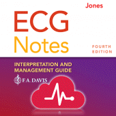 ECG Notes: Quick look-up ref. Apk