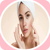 End Acne with Home Remedies Apk